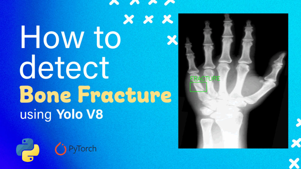 bone fracture detection