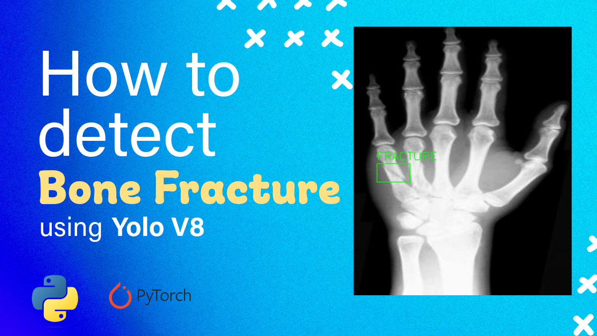 How to train YOLOv8 bone fracture detection on X-rays
