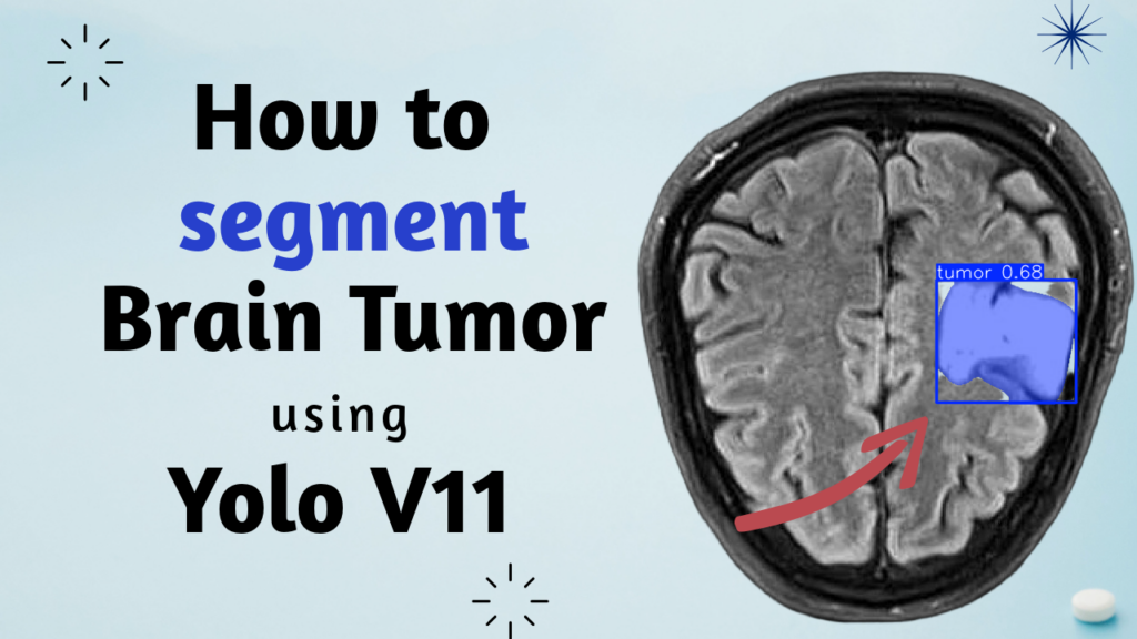 Brain Tumor Segmentation with YOLOv11 in Python 1 Brain Tumor Segmentation