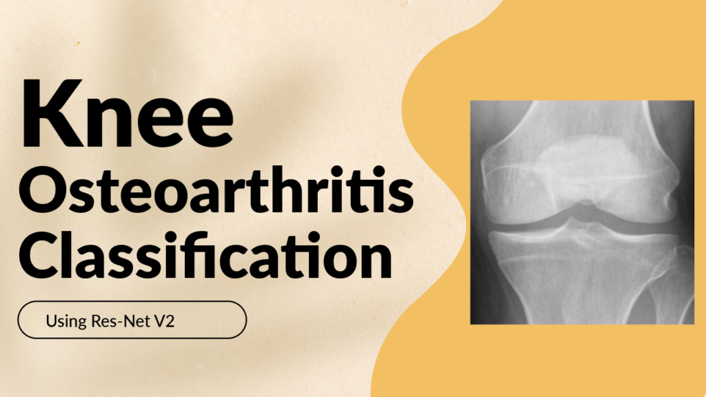 Classifying Knee X-Rays with ResNet152V2 & TensorFlow 9 ResNet152V2 TensorFlow Tutorial