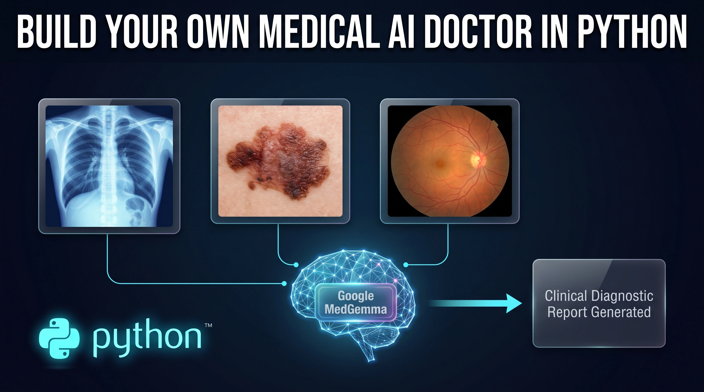 Build Your Own Medical AI with Google MedGemma and Python 1 Build Your Own Medical AI Doctor in Python